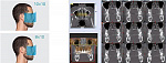 Стоматологический томограф NewTom 2D/3D GO (10x10) с цефалостатом - Фото 8
