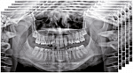 Стоматологический томограф NewTom 2D/3D GO (10x10) - Фото 7