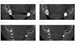 Стоматологический томограф NewTom 2D/3D GO (10x10) с цефалостатом - Фото 10