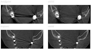 Стоматологический томограф NewTom 2D/3D GO (10x10) с цефалостатом - Фото 10